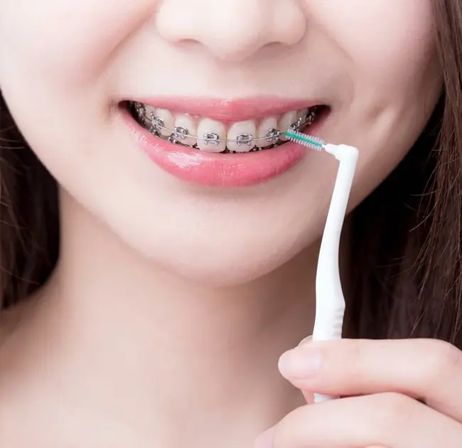 İnterdental Fırçalar Zərif Ağız Baxımında Yeni Təcrübə yaradır
